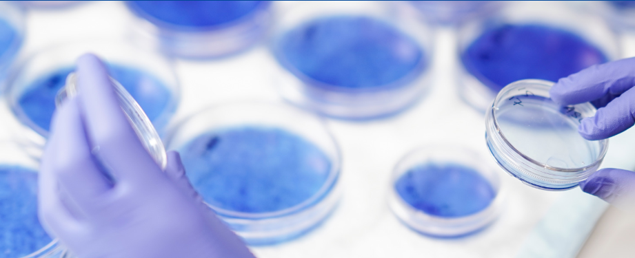 petri dishes on a lab counter